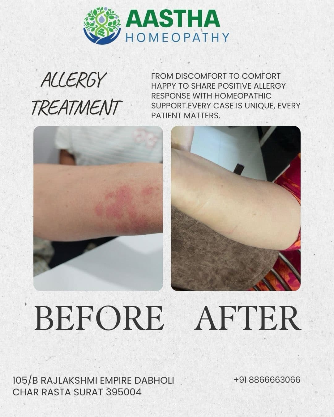 Patient result flyer: Before and After comparison