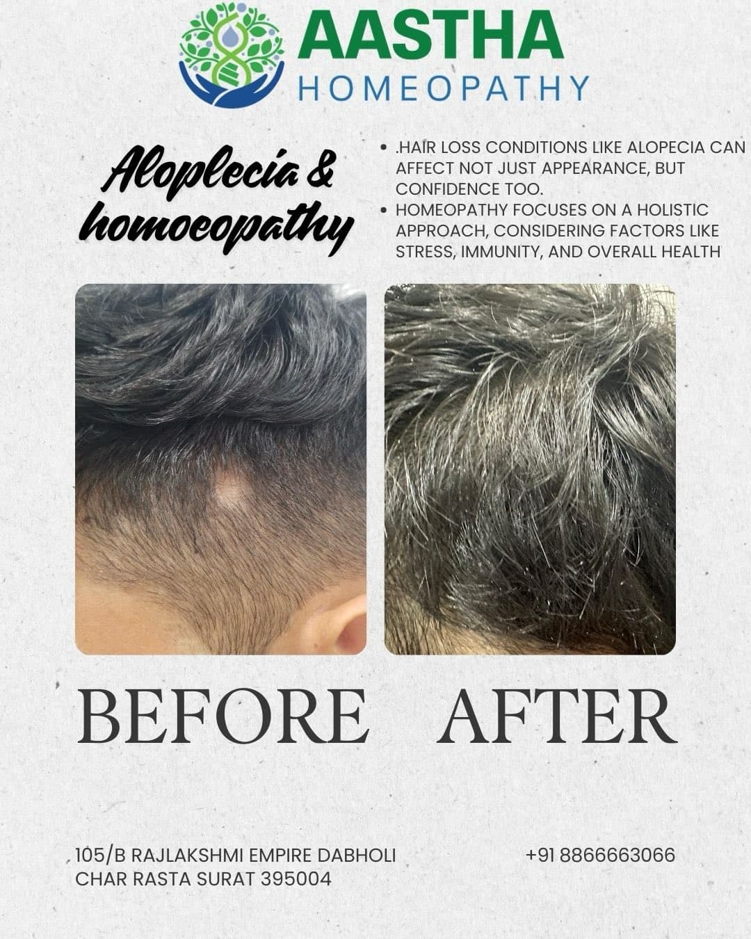Patient result flyer: Before and After comparison