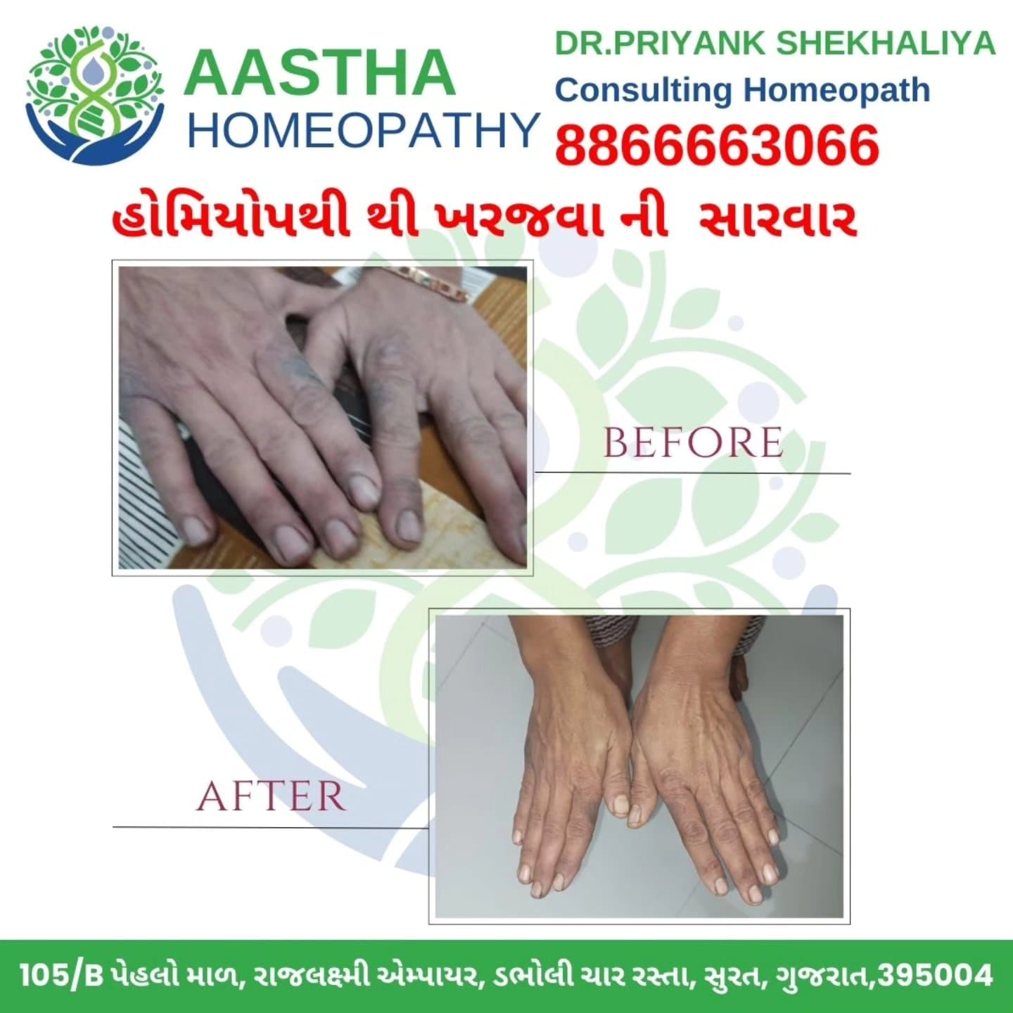 Patient result flyer: Before and After comparison