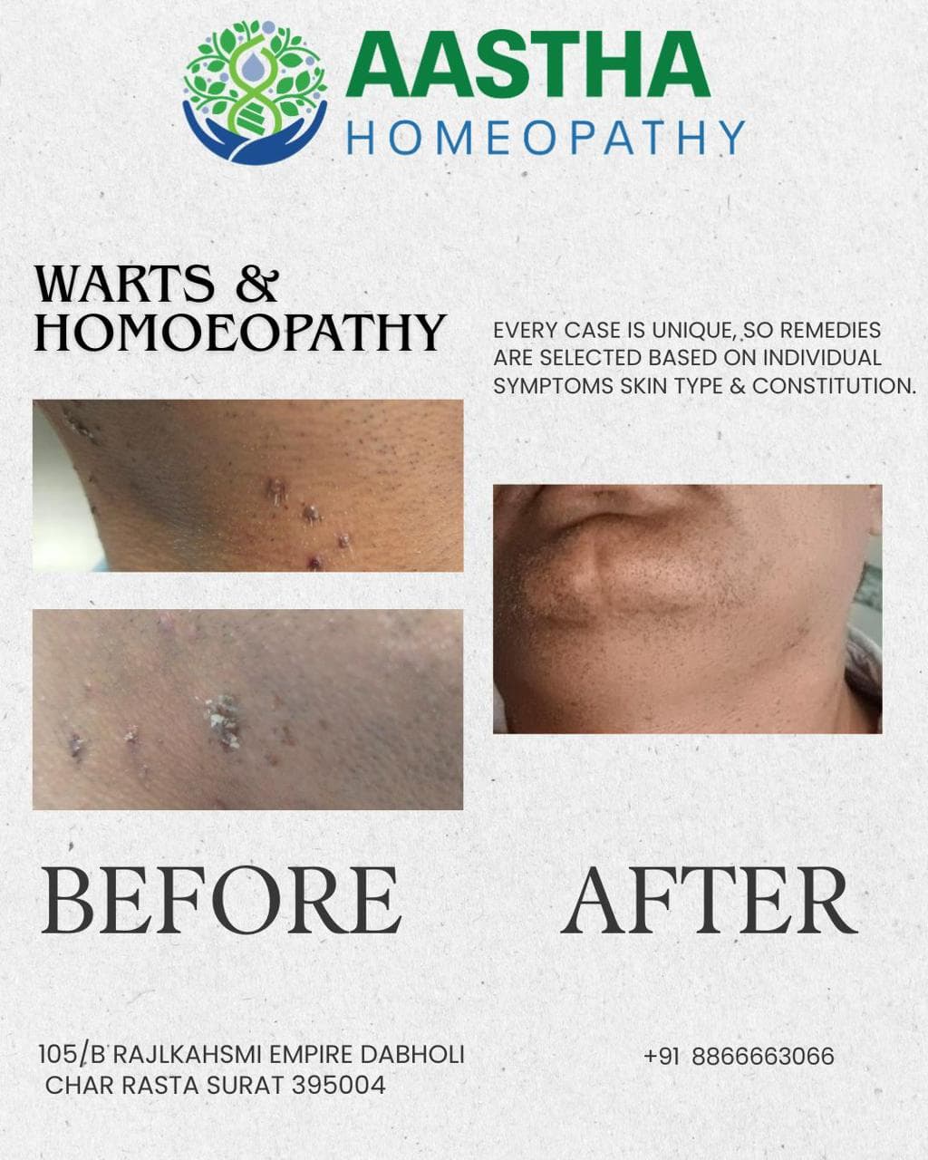Patient result flyer: Before and After comparison