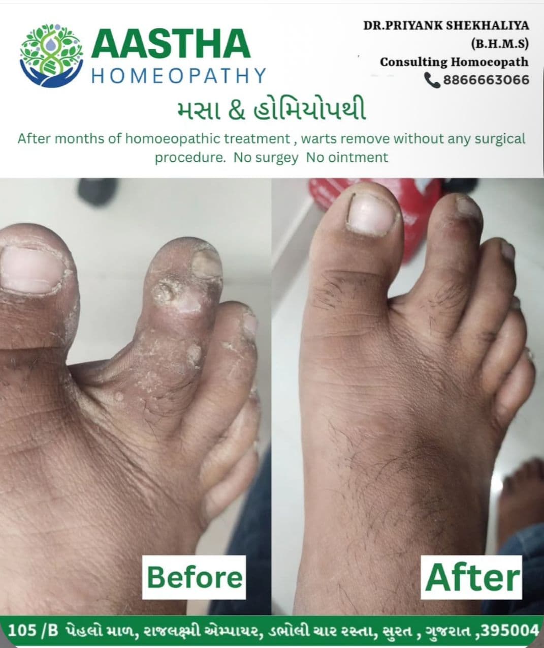 Patient result flyer: Before and After comparison