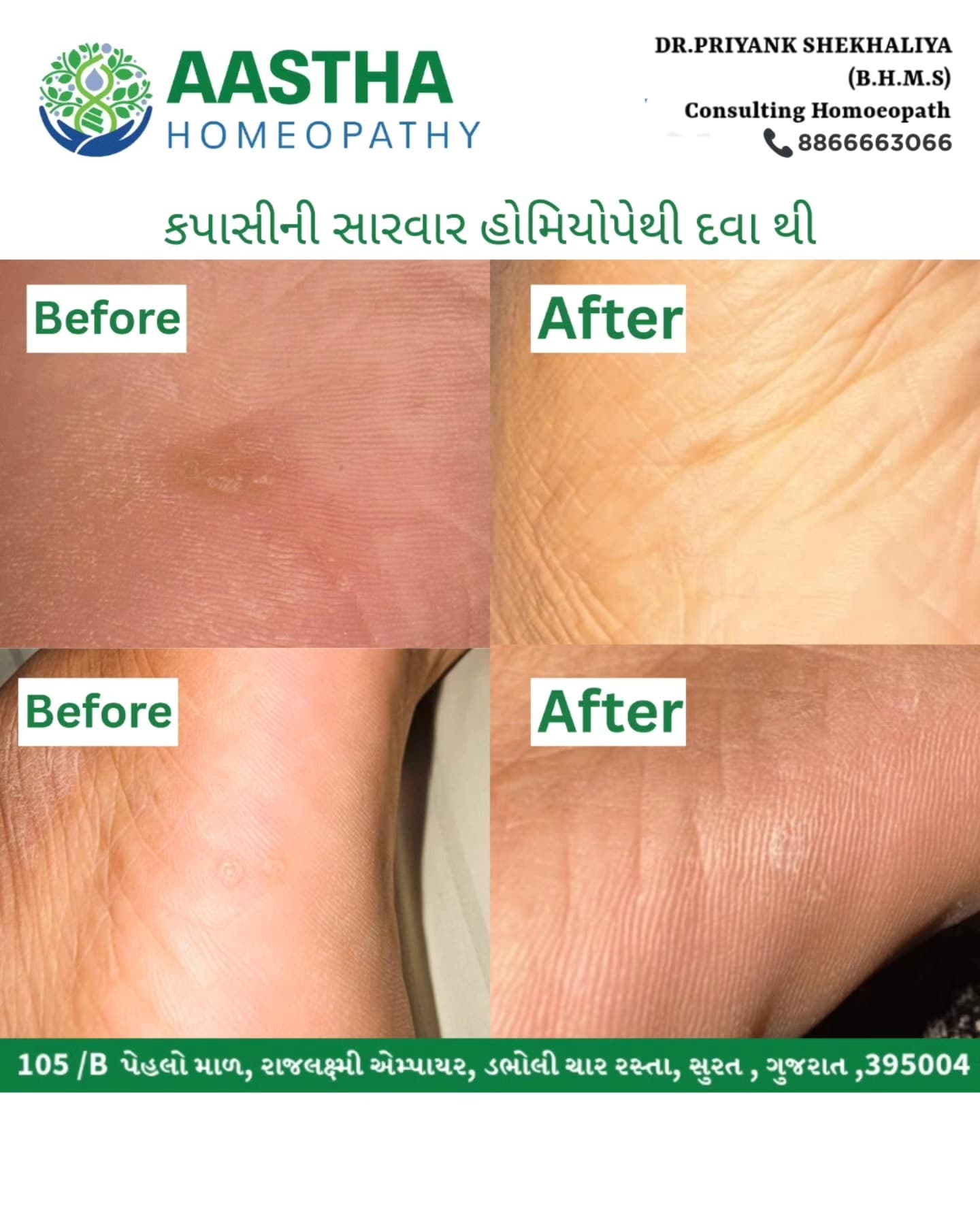 Patient result flyer: Before and After comparison