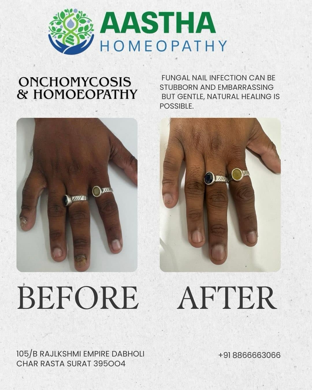 Patient result flyer: Before and After comparison