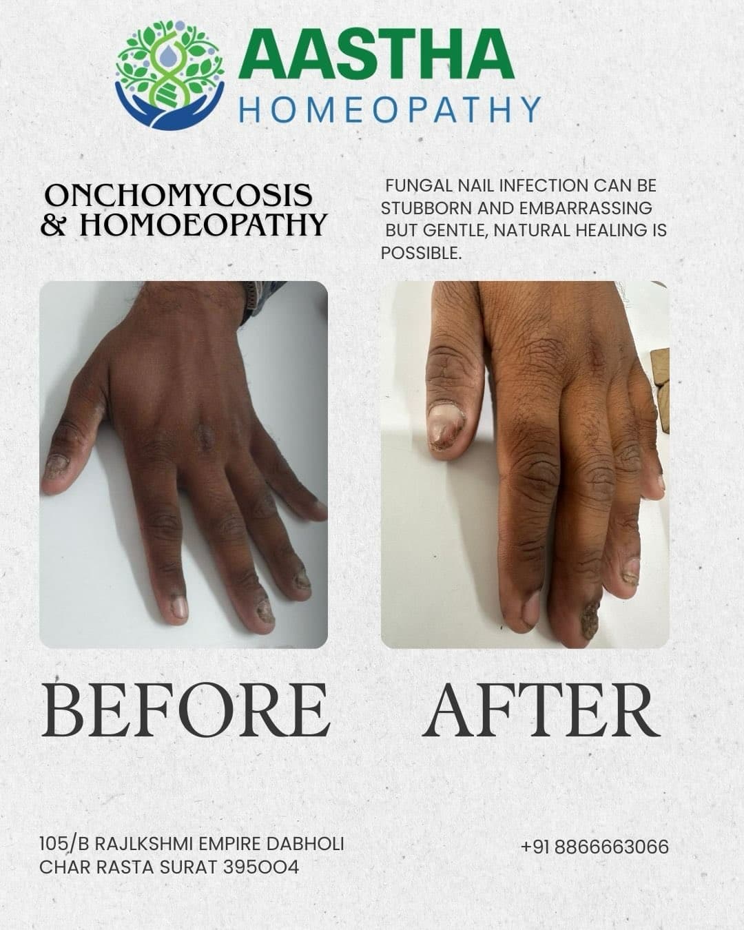 Patient result flyer: Before and After comparison