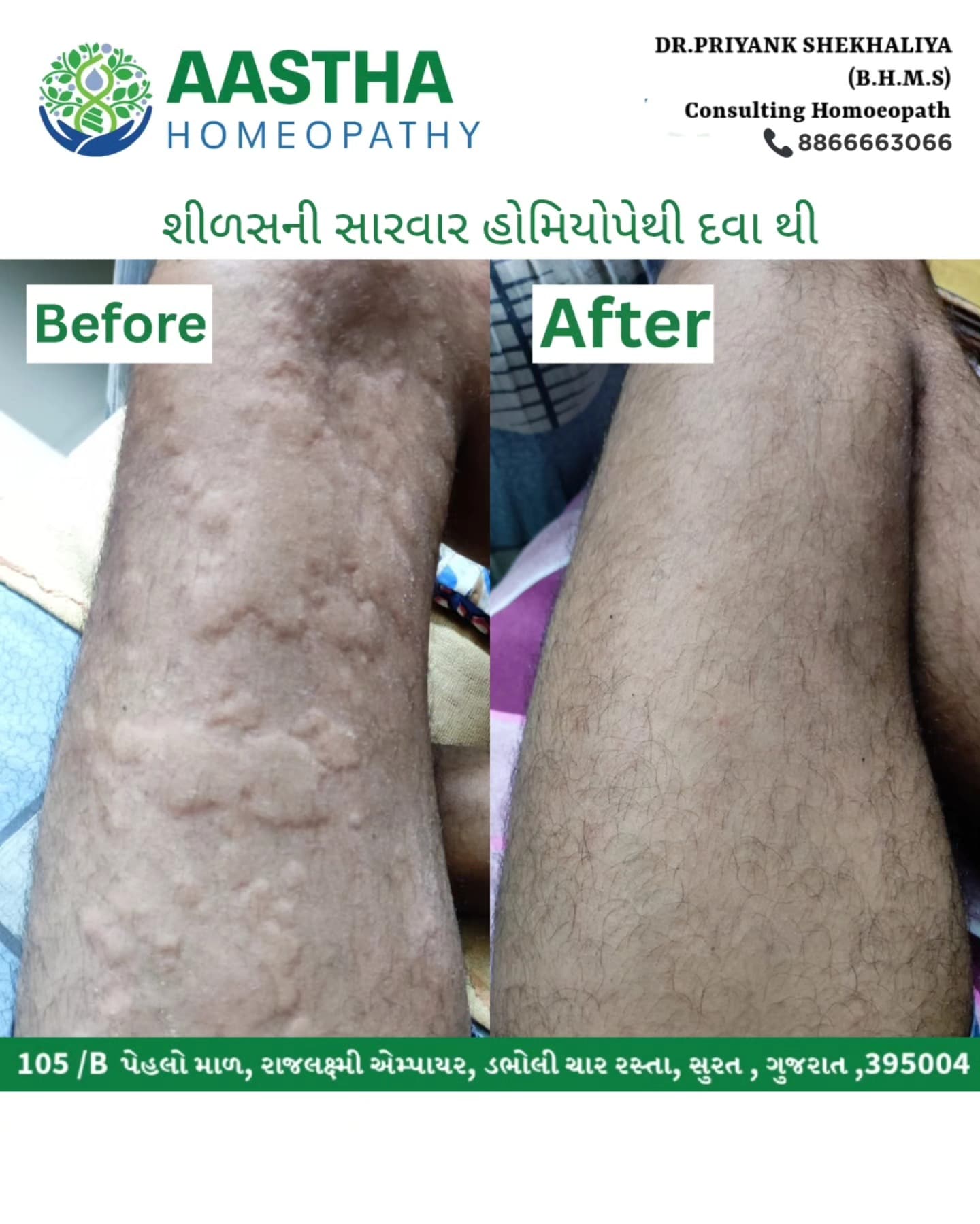Patient result flyer: Before and After comparison